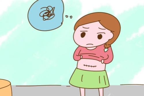 剖腹产疤痕卡通图
