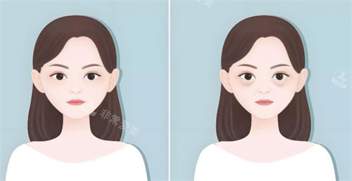 开封启美整形官网简介:祛眼袋/提眉技术赞_可在线预约_查价!