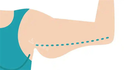 韩国釜山抽脂哪家整形医院好?依据口碑排行榜我选择了cc整形外科,来看下结果吧!