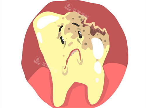 龋齿卡通