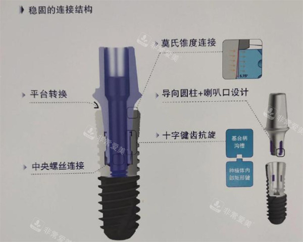 威高wego种植牙细节植体照片