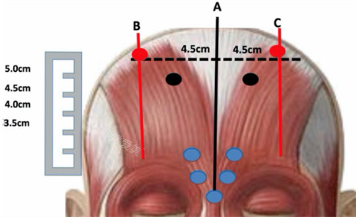 三点提眉是什么