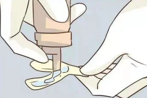 儿牙涂氟展示图