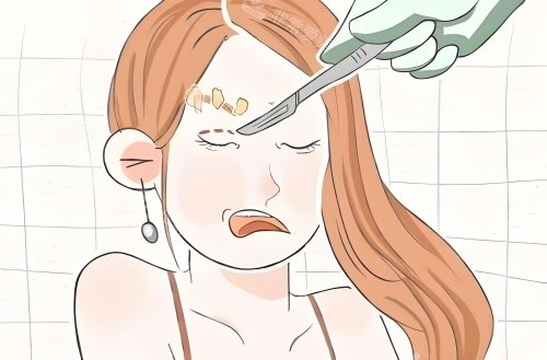 割眼角漫画示意图