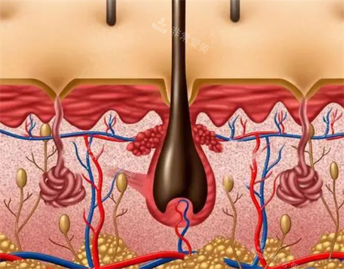 韩国做发际线种植好的医院有哪些？整理发际线靠谱医院名单给大家参考！