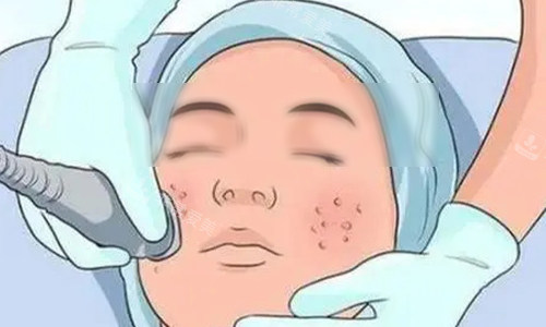 超声炮的操作动画示意图 超声炮的操作动画示意图