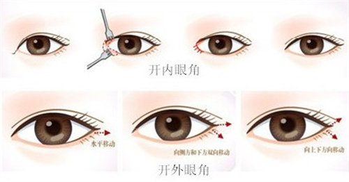 廊坊艺启美医美机构怎...