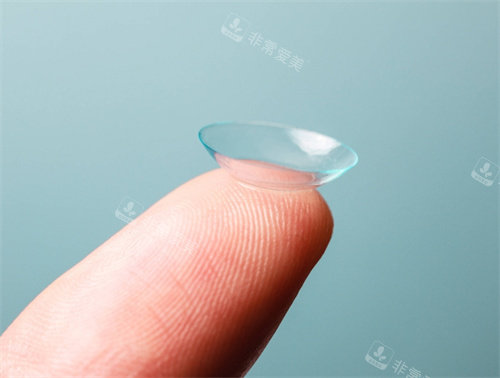 角膜塑形镜示意图