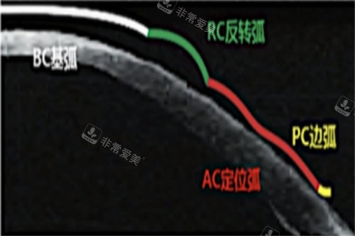 角膜塑形镜各弧区示意图