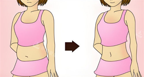 吸脂对比图 吸脂对比图