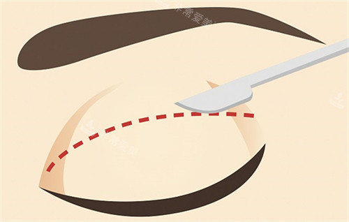 西安美合医疗美容正规吗？持正规医疗执业许可，合规经营+二类标准器械，变漂亮更放心！