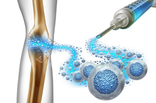 注射干细胞治疗膝盖图