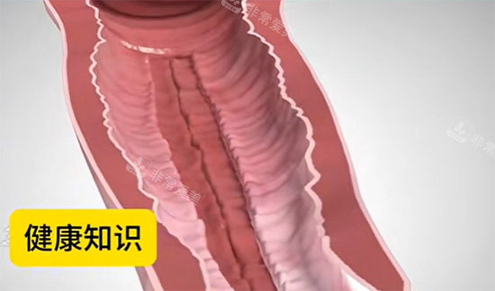 韩国鳄鱼环紧缩术体验日记!术后有效改善阴道松弛的问题!