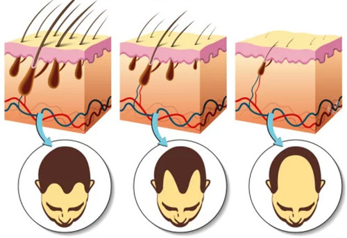 广州倍生植发医院是正规医院吗?口碑怎么样?广州倍生植发医院网友评价+地址路线+价格表一览! 