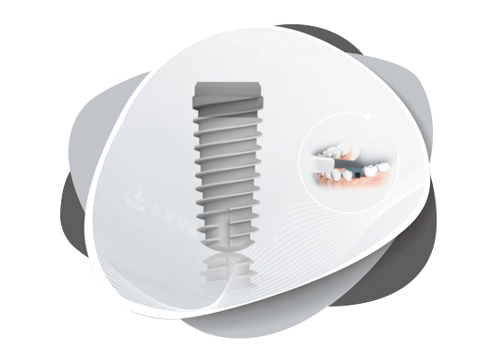 大清西格种植牙照片图