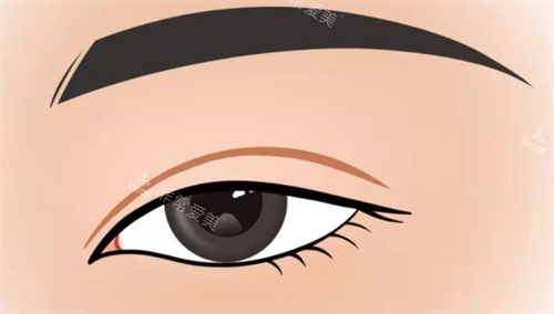 双眼皮形态展示