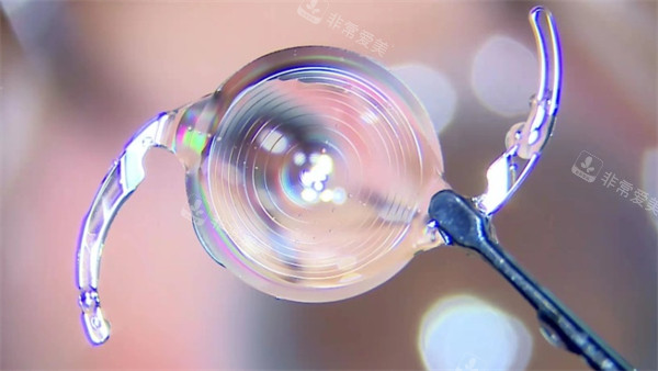 白内障晶体示意图