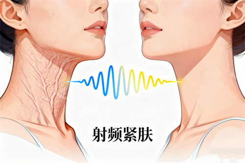 射频紧肤前后对比图