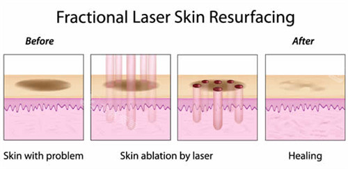 韩国bellissimo皮肤科...