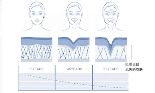 胶原蛋白流失的皮肤