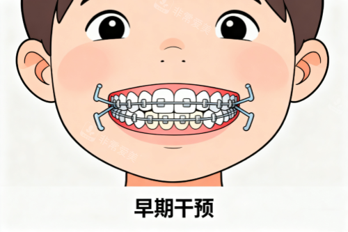 儿牙早期干预卡通图