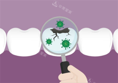 牙齿有疾病示意图