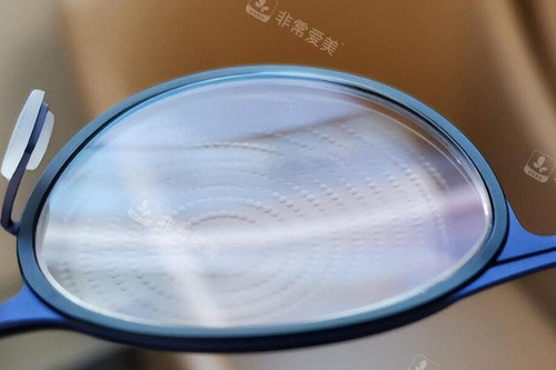 离焦镜片改善材料图展示