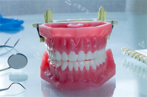 牙齿模型图片展示图片