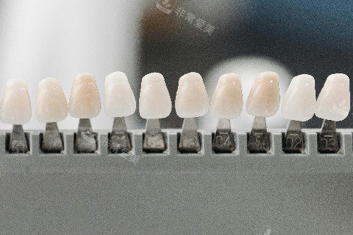 牙齿贴面色号