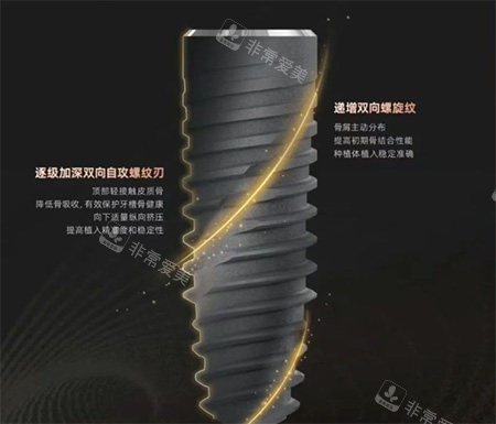 卡尔斯种植牙种植体螺纹照片