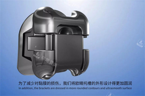 欧晴自锁托槽 (15)