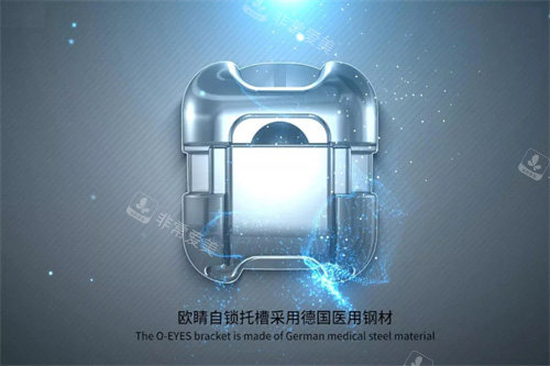 欧晴自锁托槽 (19)