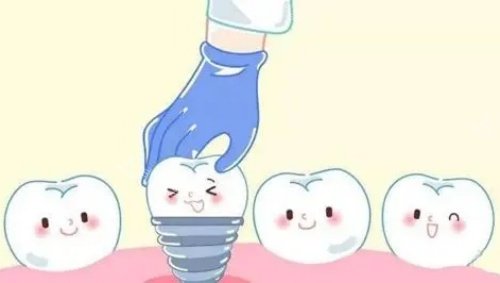 单颗牙齿种植示意图