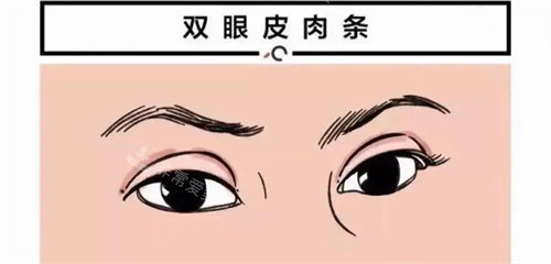 太原弓军胜双眼皮怎么样?修复手术价格，美媛荟医疗美容医院坐诊时间均可查!