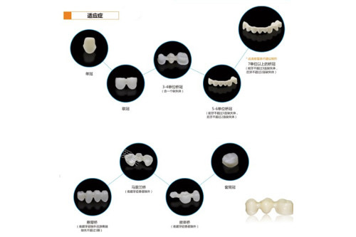 氧化锆MT普透牙冠适应症图