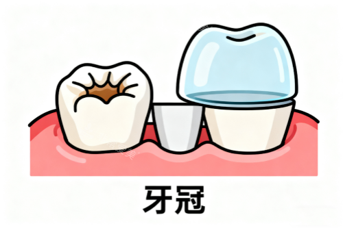 牙冠卡通图片展示