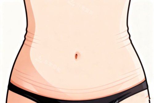 腹壁成型术卡通图