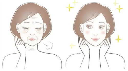 脸部抗衰前后对比