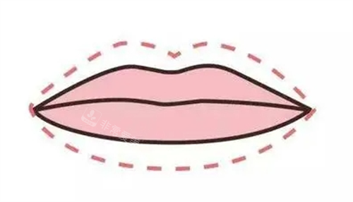 唇部丰唇动画画线图