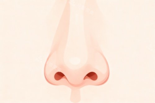 鼻子做整形成果图 鼻子做整形成果图