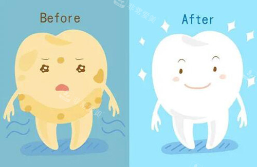 韩国牙齿美白哪家牙科医院比较好？这份精选名单请收好！