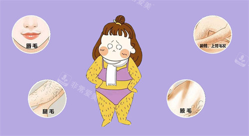 不同区域需脱毛的毛发