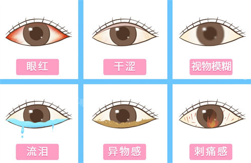 干眼症的表现