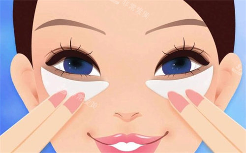 双眼皮术后卡通图 双眼皮术后卡通图