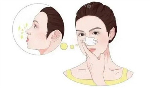 微晶瓷注射隆鼻