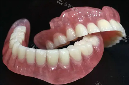 吸附式假牙半口模型展示