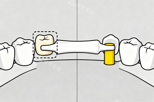 镶牙卡通展示图