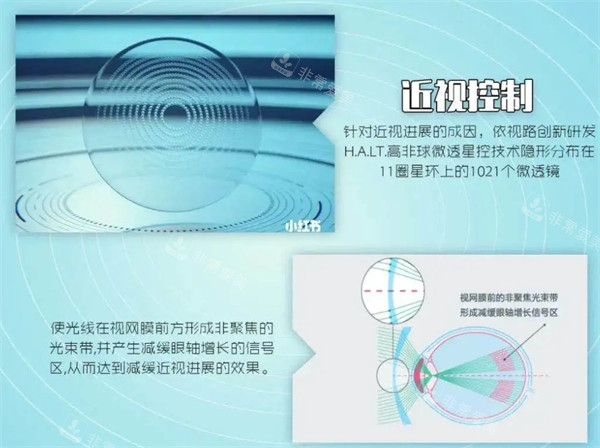 近视控制原理图解