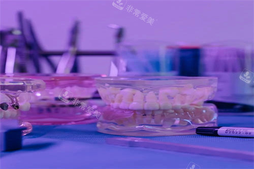 牙齿模型示意图展示