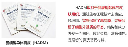 3d生物束带紧缩术材料示意图 3d生物束带紧缩术材料示意图